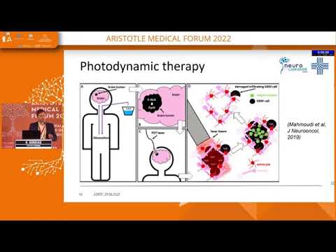K. Gousias - Local therapies against glioblastomas; is a closer combat more effective