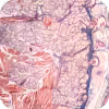 Image Here