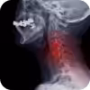Image Here