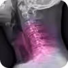 Image Here