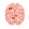 Image Here