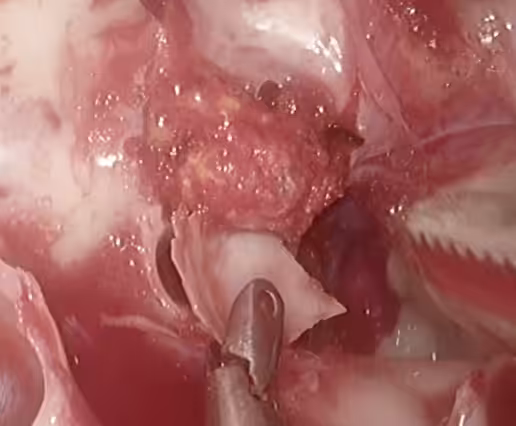 Image Here