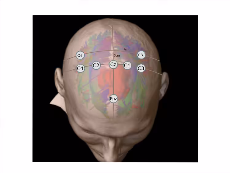 Image Here