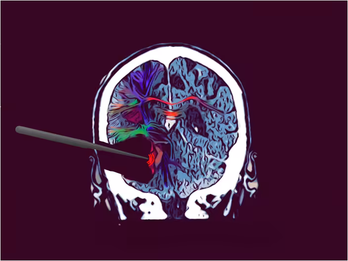 Image Here