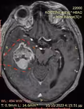 Image Here