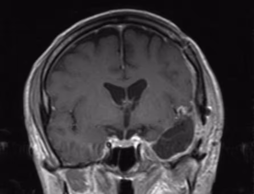 Image Here