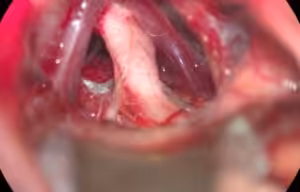 Image Here