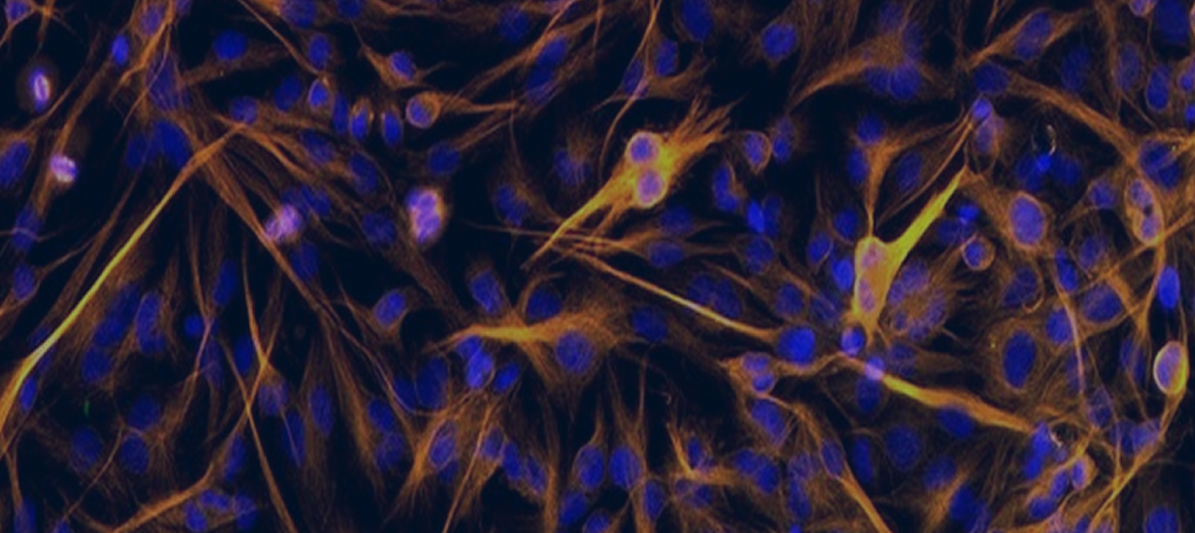 Image Banner Mobile Here