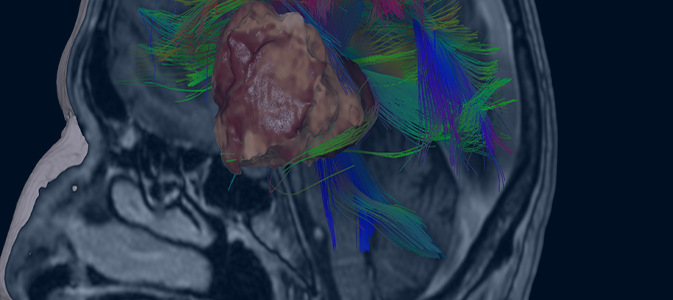 Image Banner Mobile Here