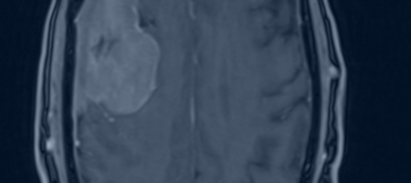 Image Banner Mobile Here