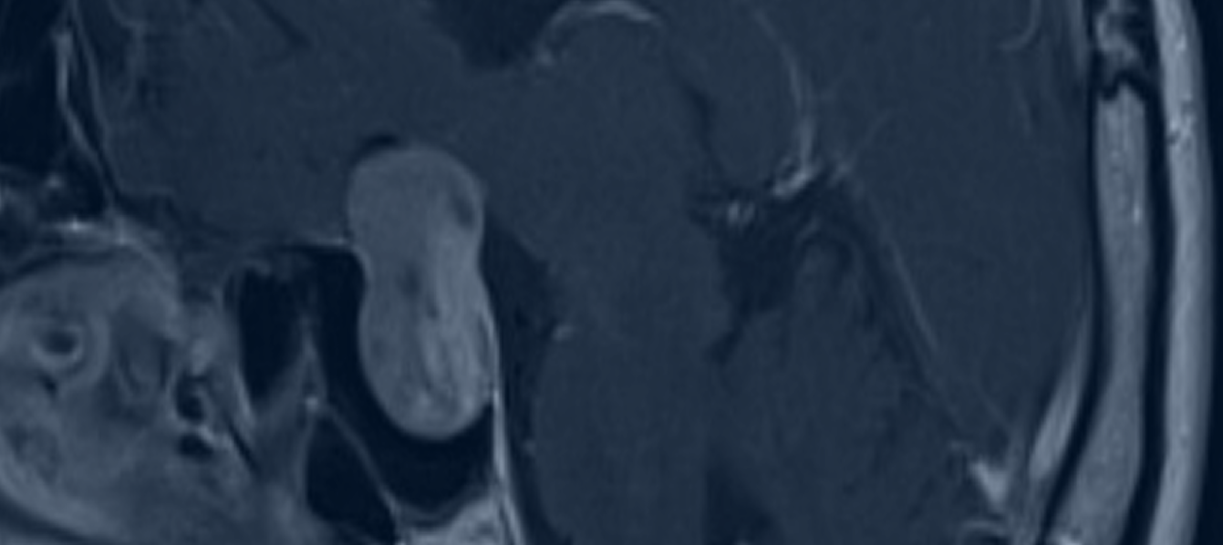 Image Banner Mobile Here