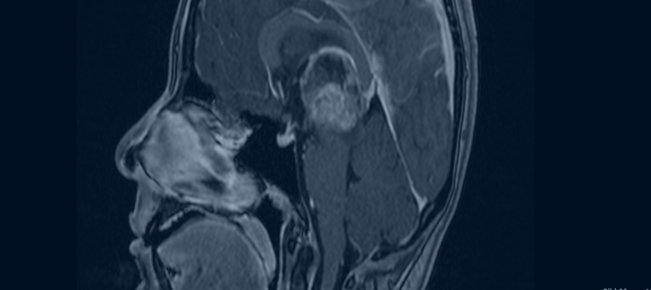 Image Banner Mobile Here