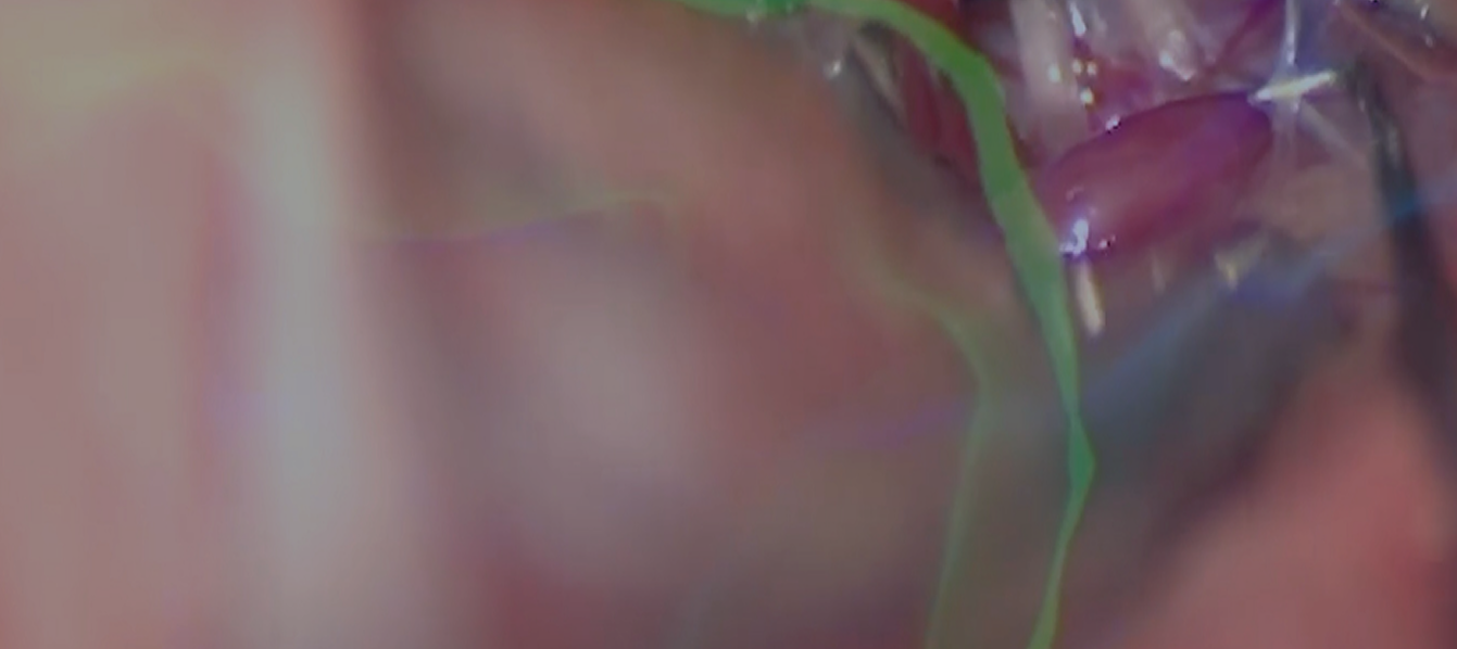 Image Banner Mobile Here