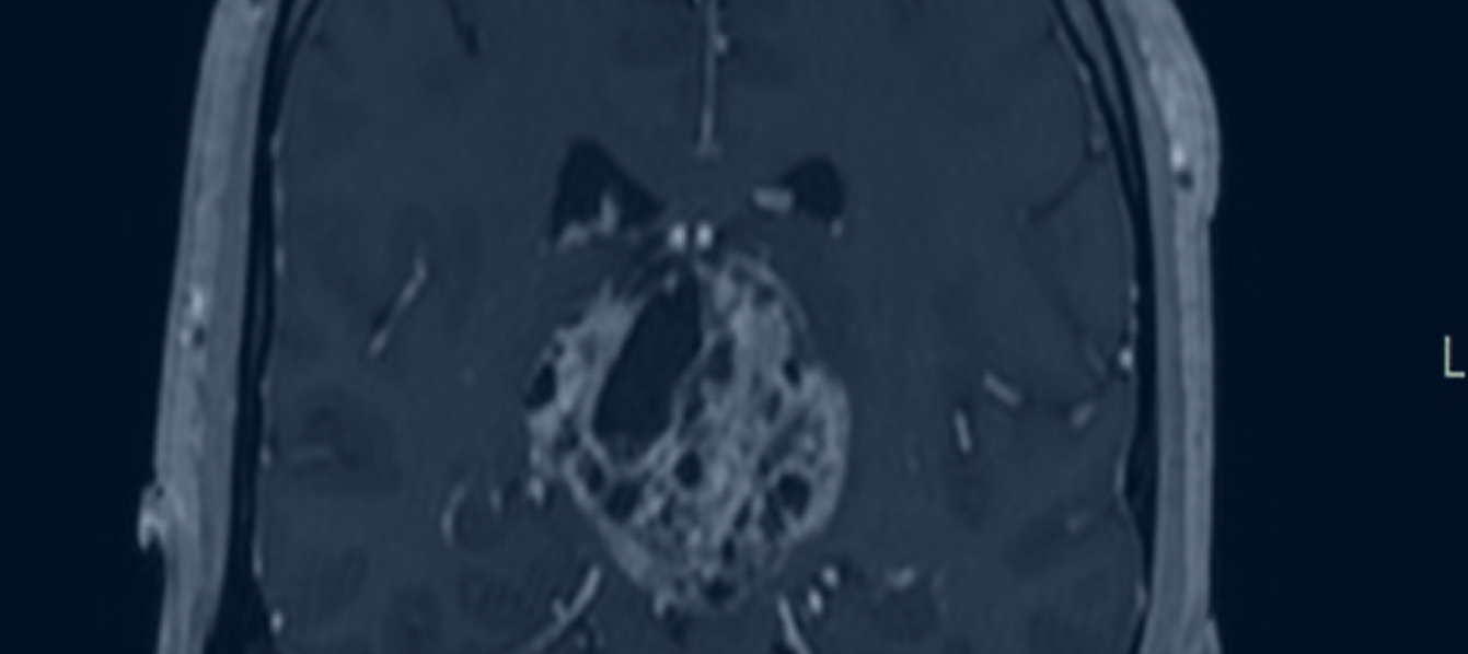 Image Banner Mobile Here