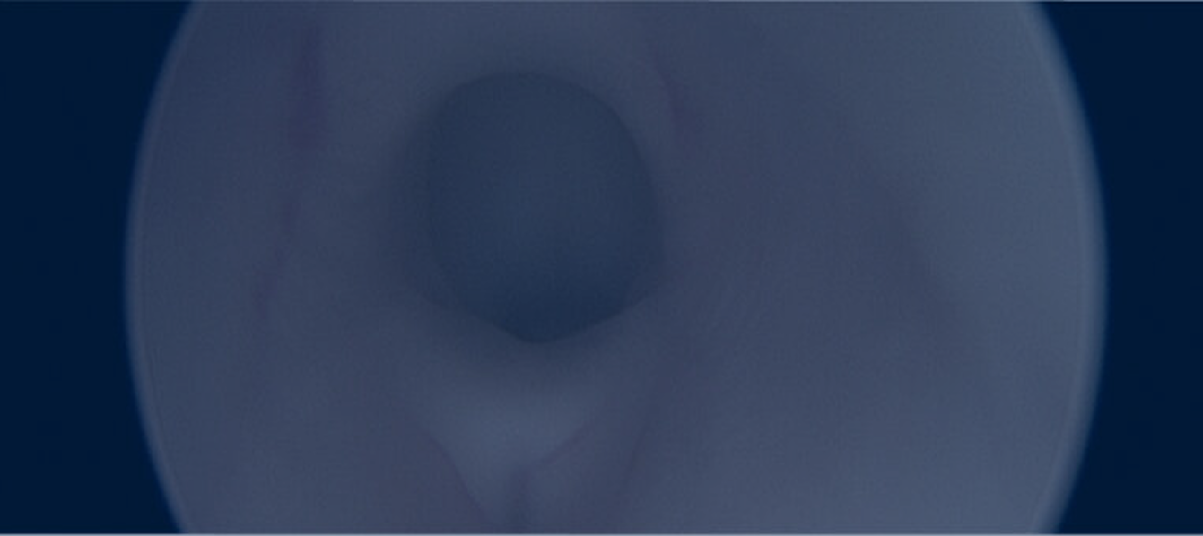 Image Banner Mobile Here